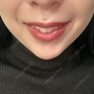 一宮美容クリニック口コミ