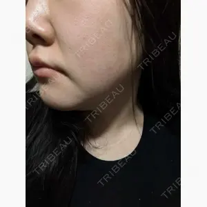 ゆきスキンクリニック 東池袋口コミ