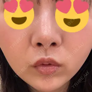 BBC表参道院口コミ