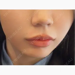 美容皮膚科エルムクリニック 大阪院口コミ