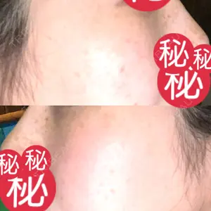 MIO CLINIC 梅田院口コミ