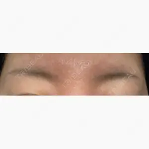 渋谷美容外科クリニック 新宿院口コミ