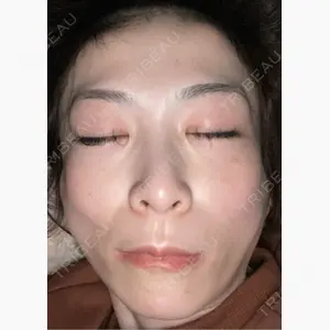 TCB東京中央美容外科 神戸院口コミ
