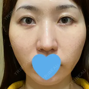 お茶の水美容形成クリニック口コミ