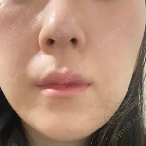 ウィルビークリニック 新宿院口コミ