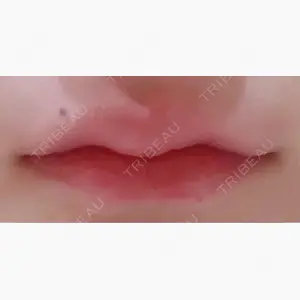 R Beauty CLINIC 銀座院口コミ