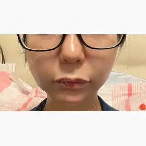 BON BON CLINIC 銀座駅前本院口コミ