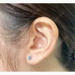 新宿ラクル美容外科クリニック 新宿院口コミ