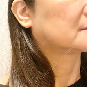 TCB東京中央美容外科 立川院口コミ