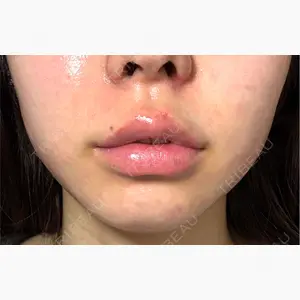 BELINDA CLINIC（ベリンダクリニック）岡山院口コミ