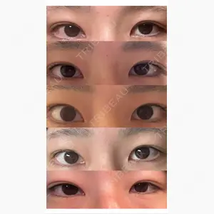 プロミス整形外科口コミ
