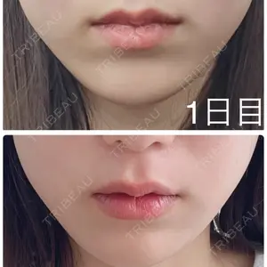 TCB東京中央美容外科 札幌大通院口コミ