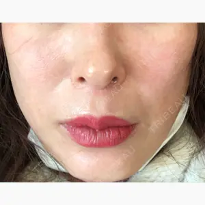 湘南美容クリニック 八王子院口コミ