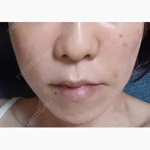 TCB東京中央美容外科 名古屋栄院口コミ