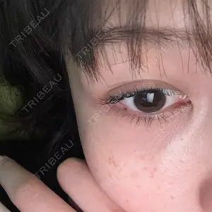 CHARIS BEAUTY CLINIC口コミ