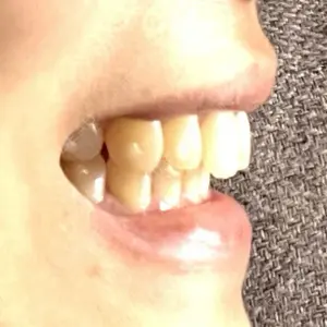 SF六本木東京 dental orthodontics口コミ