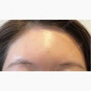 ニュービューティークリニック口コミ