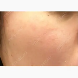 アマリラビューティークリニック口コミ