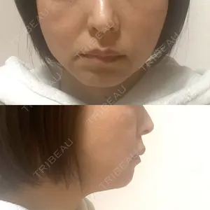 BON BON CLINIC 銀座駅前本院口コミ