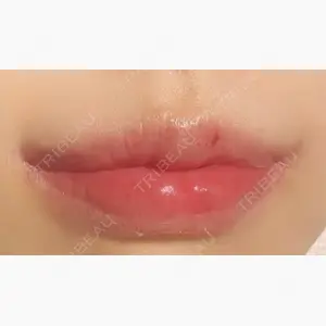 R Beauty CLINIC 銀座院口コミ