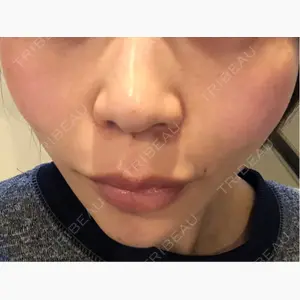 BON BON CLINIC 銀座駅前本院口コミ