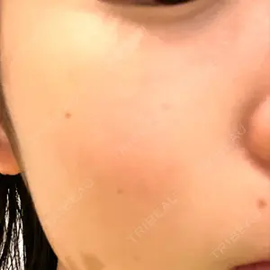 サクラアズクリニック 天神院口コミ