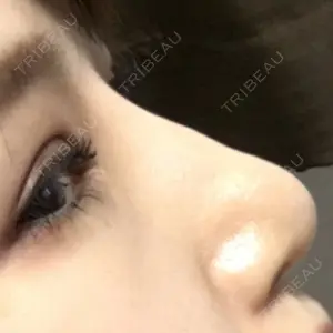 赤坂プレミアクリニック口コミ