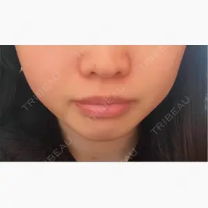 ミケイ医院口コミ