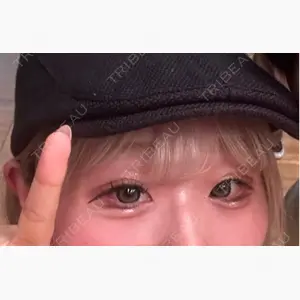 R Beauty CLINIC 銀座院口コミ