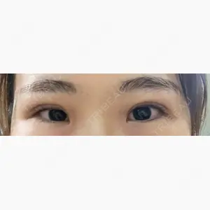 X CLINIC 大阪院口コミ