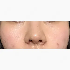 東京シンデレラ美容外科 池袋院口コミ