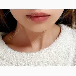 TCB東京中央美容外科 長野院口コミ