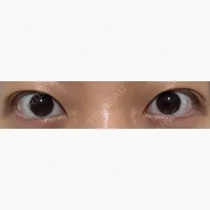 オアシス美容外科口コミ