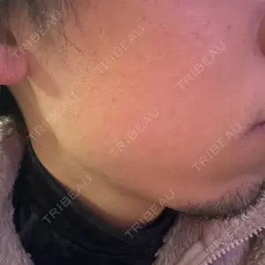 メディカルアルファクリニック口コミ