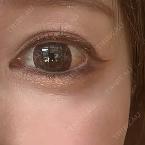 ロレシー美容クリニック 心斎橋駅前院口コミ