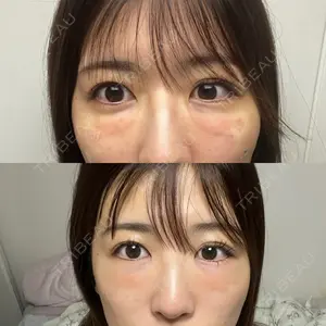 湘南美容クリニック 池袋東口院口コミ