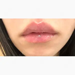 オラクル美容皮膚科 福岡天神院口コミ