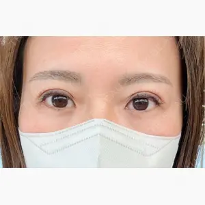 HAAB×DREAM BEAUTY CLINIC 東京本院口コミ