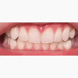 RIVER CLINIC DENTAL口コミ