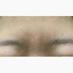 新宿皮膚科ゆうスキンクリニック 新宿院口コミ