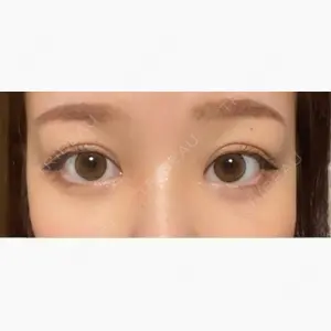 R Beauty CLINIC 大阪院口コミ