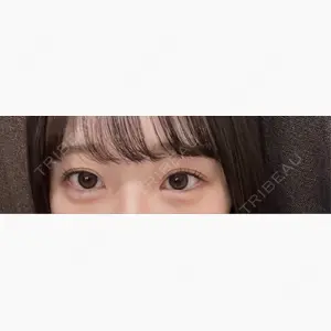 LUHO（ルホ）美容外科口コミ