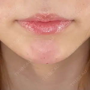 HAAB×DREAM BEAUTY CLINIC 大阪梅田院口コミ