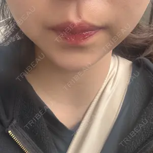 TCB東京中央美容外科 草津院口コミ