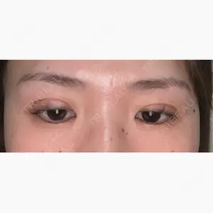 NARU Beauty Clinic 【ナルクリ】口コミ