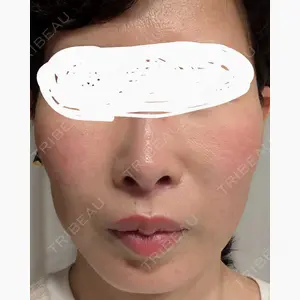 Chloe Cheongdam Clinic （クロエチョンダムクリニック）口コミ