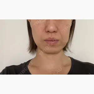 Mods Clinic（モッズクリニック） 東京院口コミ