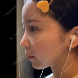 グローバルビューティークリニック 東京院口コミ