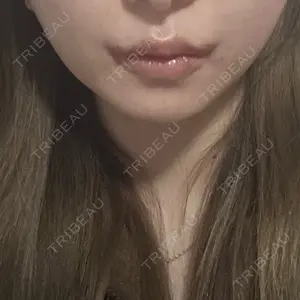 R Beauty CLINIC 銀座院口コミ