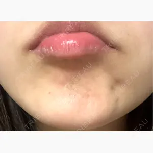 ジョウクリニック 大阪院口コミ